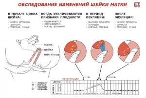 Изменения шейки матки