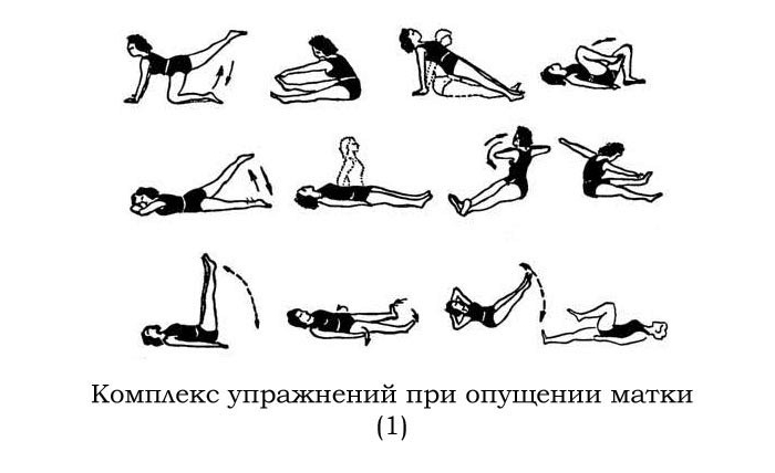 Упражнения Кегеля при опущении матки у женщин