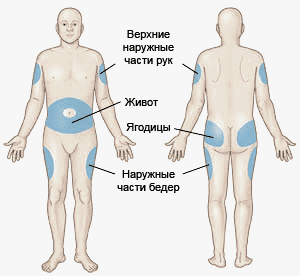 Зоны для инсулиновых инъекций