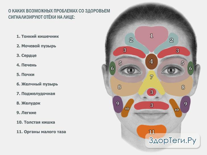 О каких болезнях сигнализируют отёки на лице