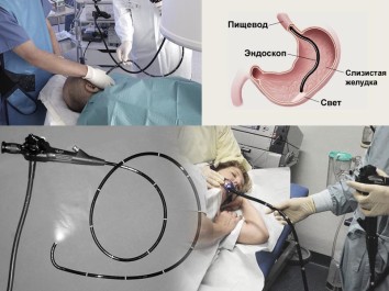 Проведение эндоскопии